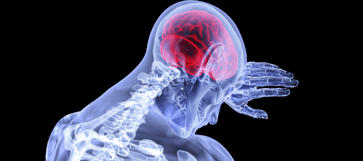 4 Things Needed to Prove Negligence in a Concussion Case